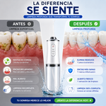 Irrigador Dental de Alta Presión | Sonrisa Fresca Todos los Días