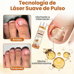 🐝FUNGI BEE - SPRAY - RESTAURADOR DE UÑAS ANTI-HONGOS CON VENENO DE ABEJA🐝